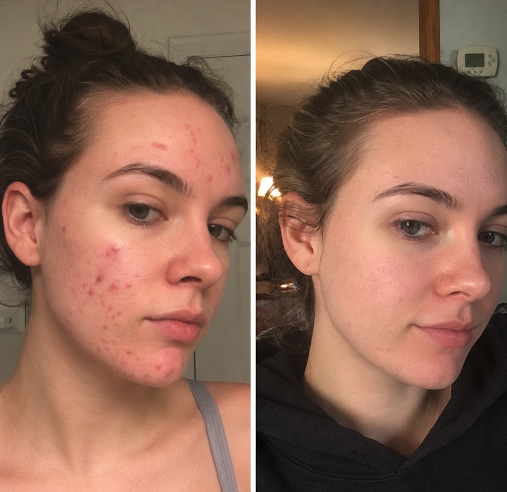 Verified customer photo from Katie F.